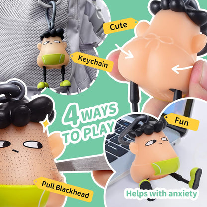🔥Summer Hot Sale Promotion-49% OFF😆-Fidget Pimple Popper Keychain Toy